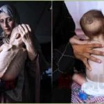 Starvation Crisis in Gaza Hospital Wards