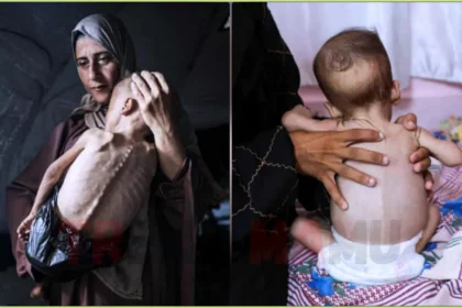 Starvation Crisis in Gaza Hospital Wards