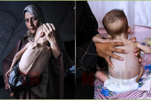 Starvation Crisis in Gaza Hospital Wards