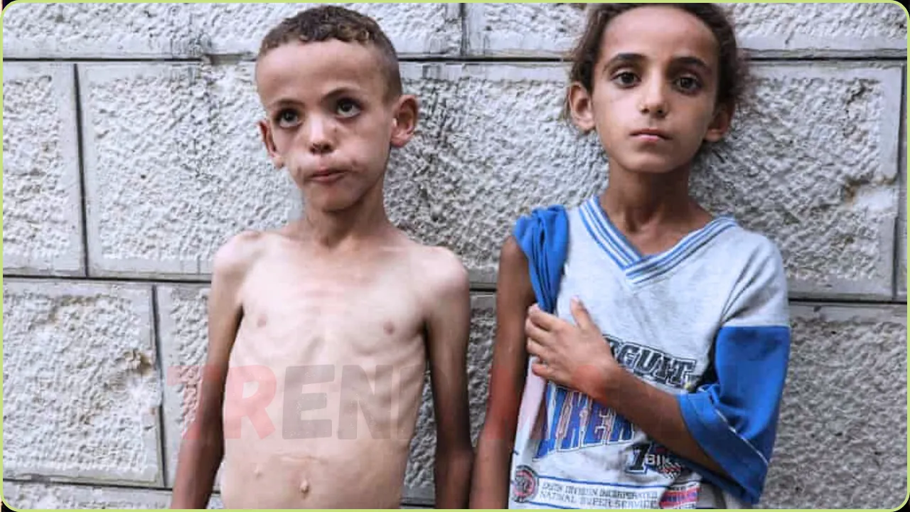 Starvation Crisis in Gaza Hospital Wards